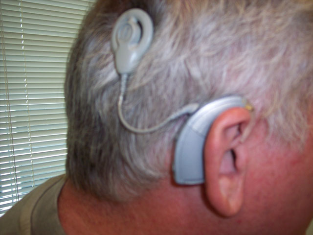 man with a cochlear implant